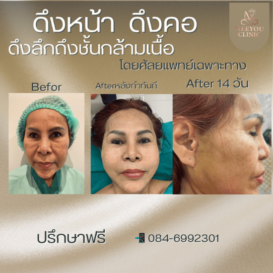 คลินิกเสริมความงาม ระยอง